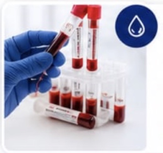 Blood tests at home